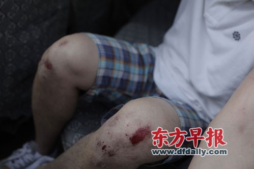 Lu Haitao Beaten Up