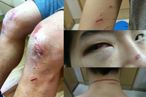 HK Student Injured by Police