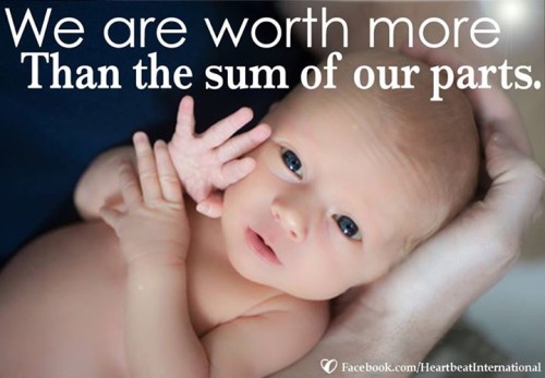 We Are Worth More...